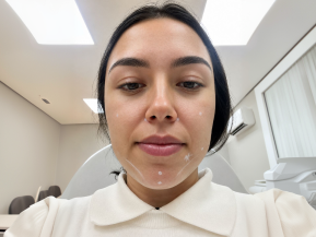 Botox da Noiva
